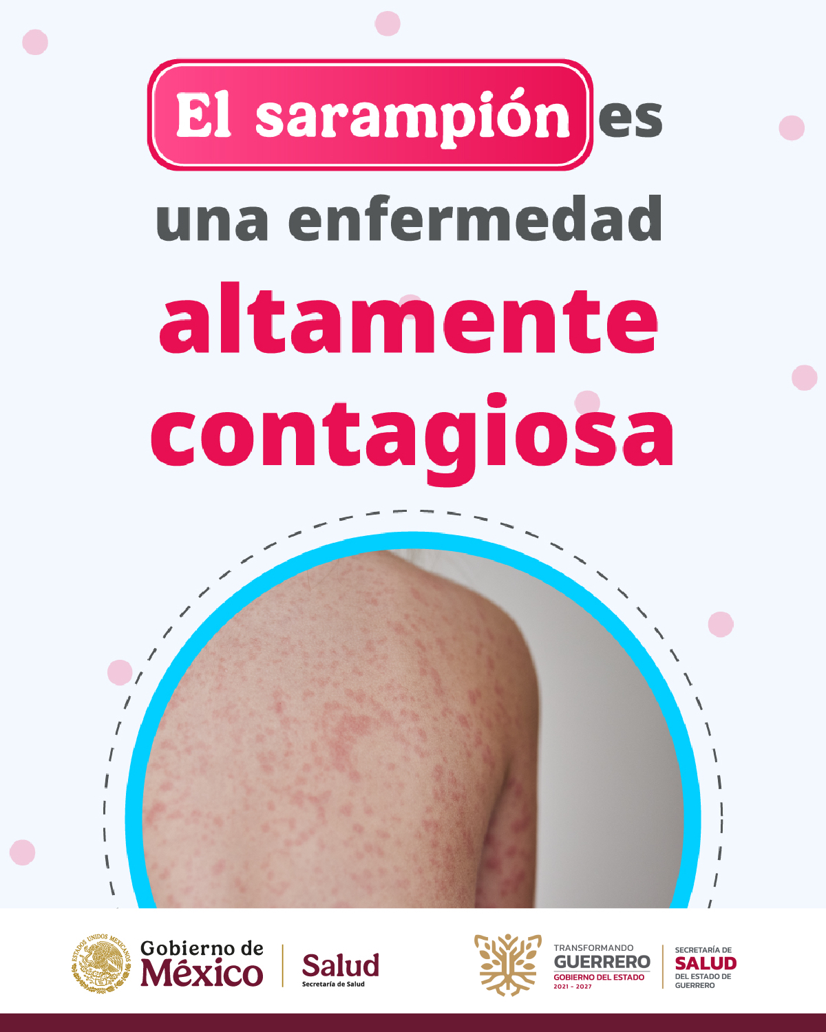 sarampion2-guerrero